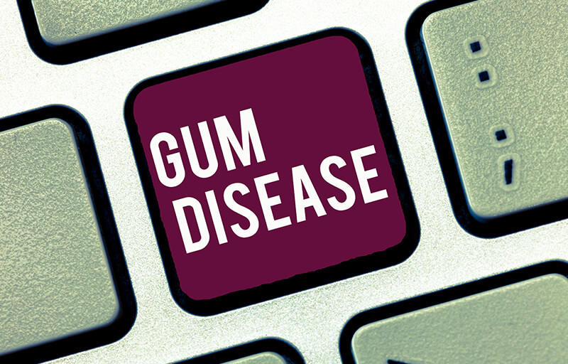 Gum Abscess Treatment, Symptoms & Causes | DentalPlans.com